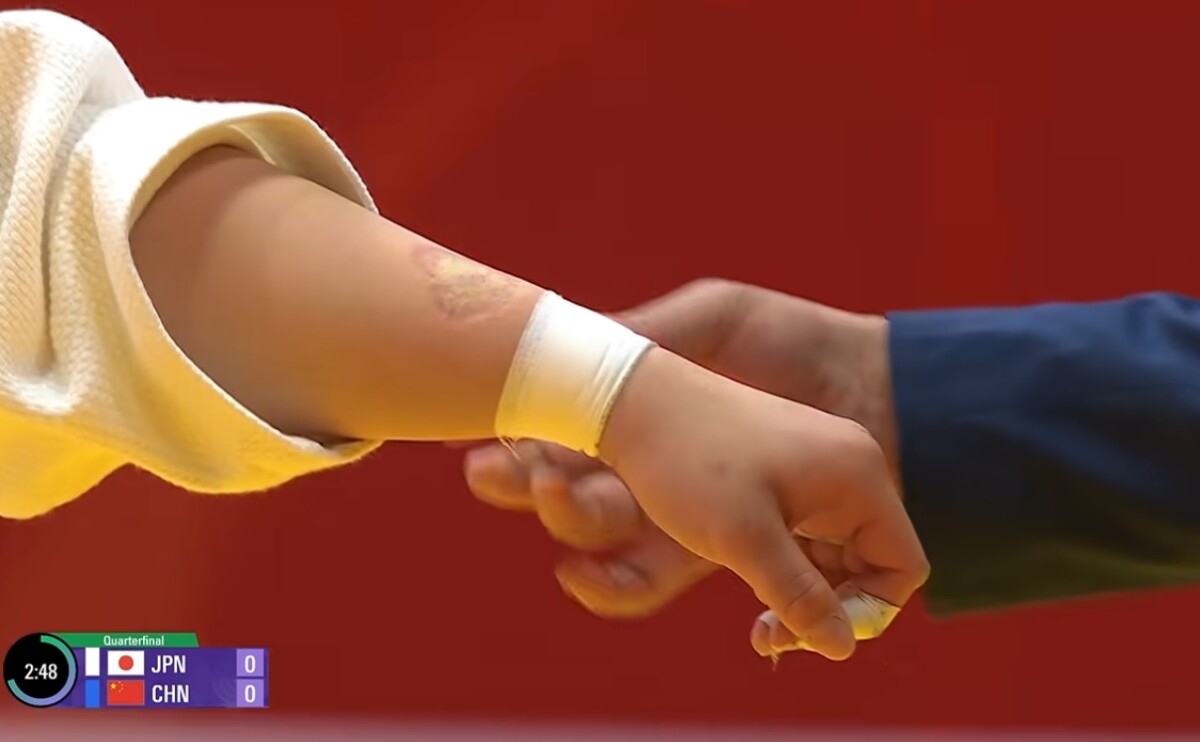 これが中国柔道女子選手が噛んだ歯形だ！（ＴＢＳ映像より）
