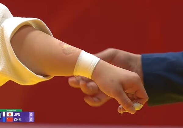 これが中国柔道女子選手が噛んだ歯形だ！（ＴＢＳ映像より）